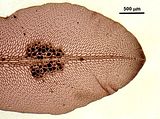 6 - Soro di tetrasporocisti